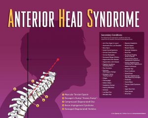 Anterior Head Syndrome